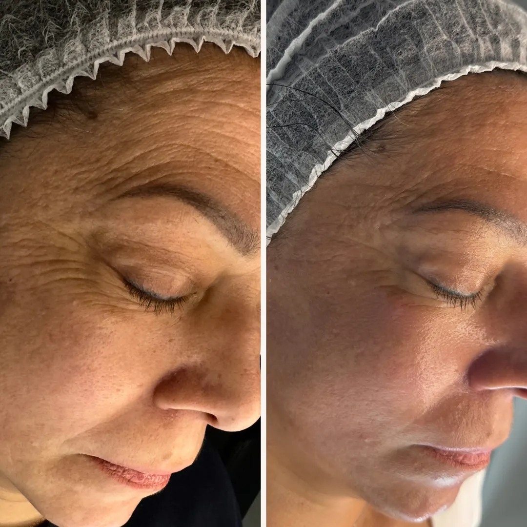 SkinCareWithMargo